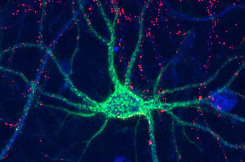 Sugars affect brain 'plasticity,' helping with learning, memory, recovery